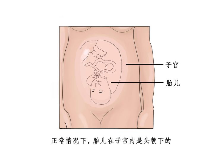 剖腹产分娩全过程图片